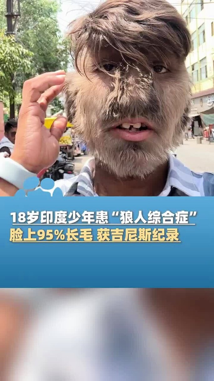 当我飞奔向你策驰影院在线观看 | 甜宠剧全集免费播放 | 校园青春高甜解说